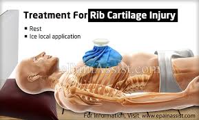 Rib Cartilage Injury