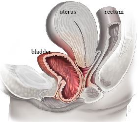 Bladder prolapse