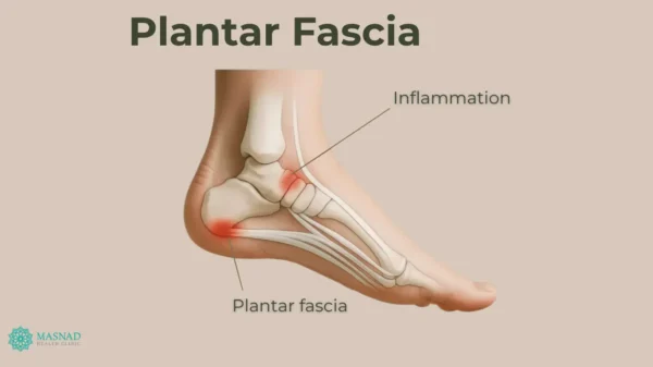 Plantar Fascia