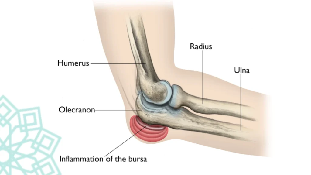 showing bursa location