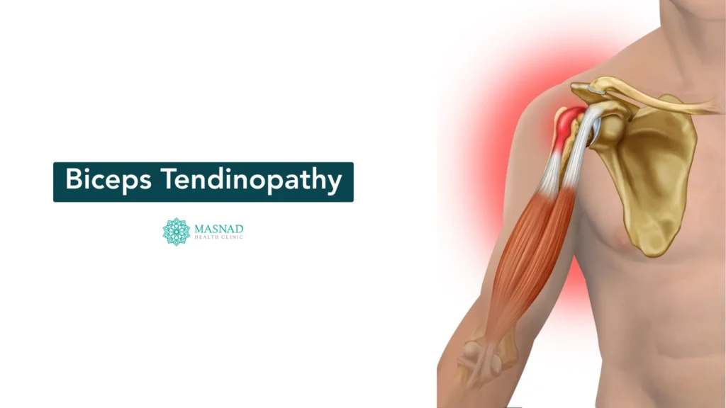 Biceps Tendinopathy