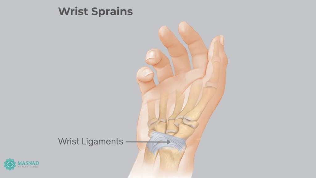 Wrist Ligaments