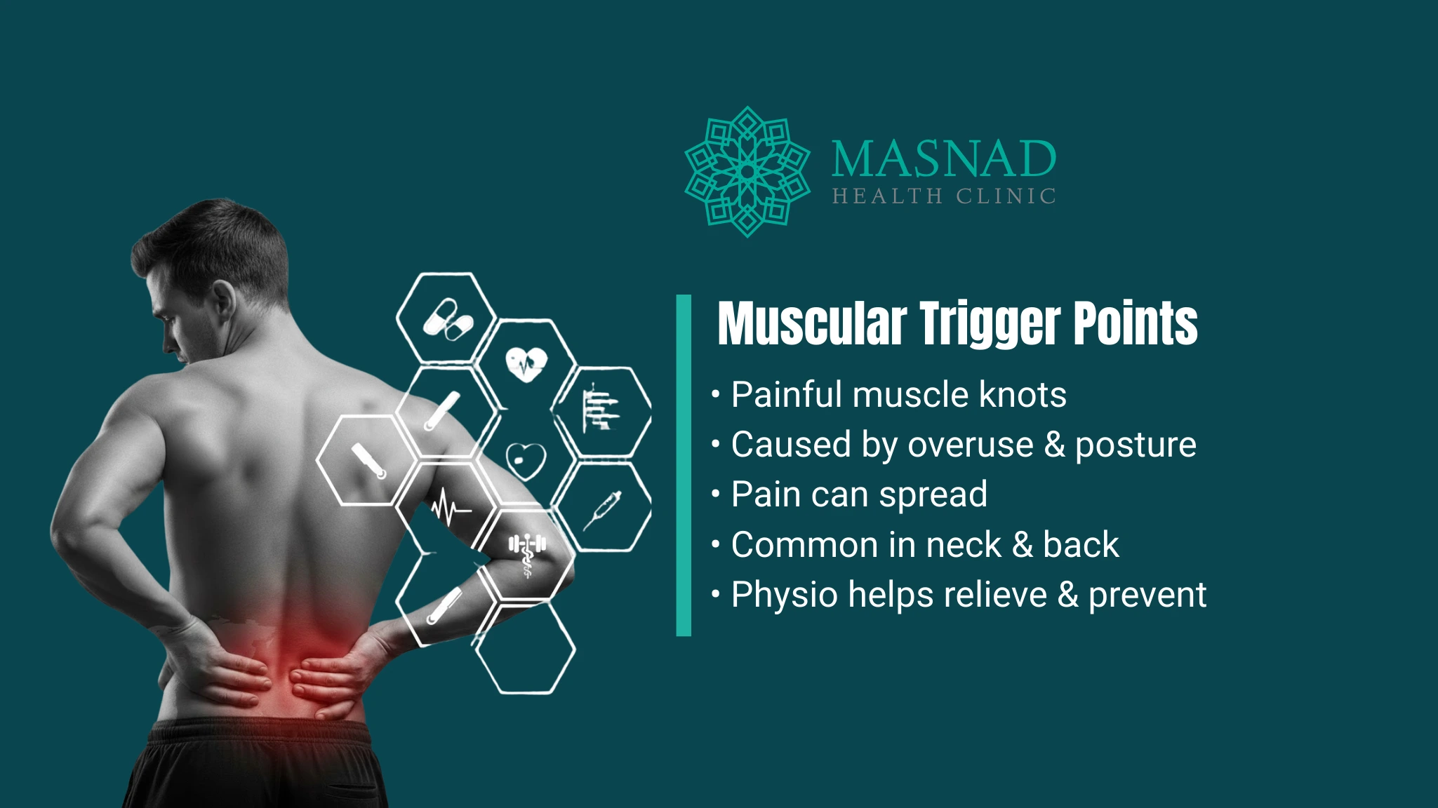 Understanding Muscular Trigger Points: Causes, Symptoms and Treatment