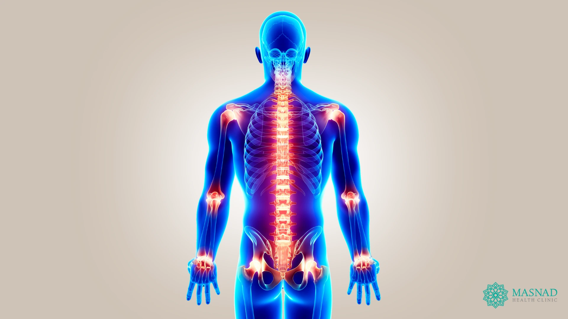 Should You Have a Joint Replacement?