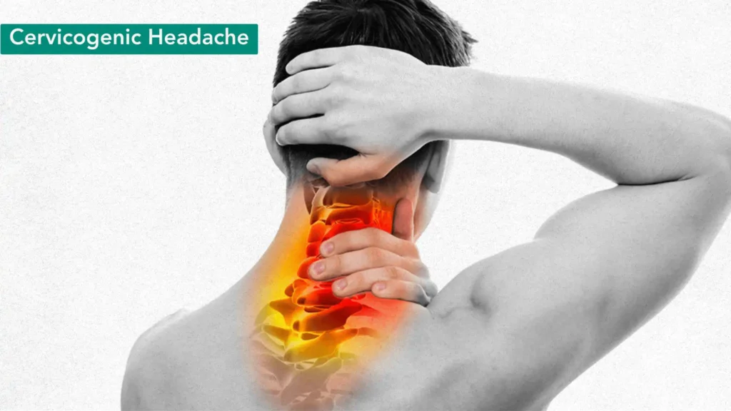 Cervicogenic Headache