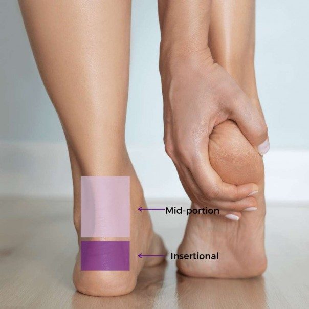 Shockwave Therapy for Achilles Tendinopathy