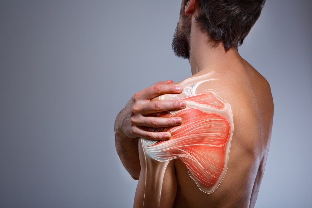 Shockwave Therapy for Rotator Cuff Tendinopa