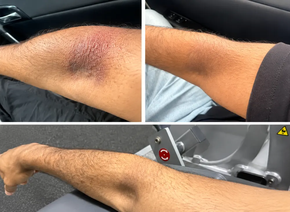Personal skin health journey showing changes in irritated skin over time