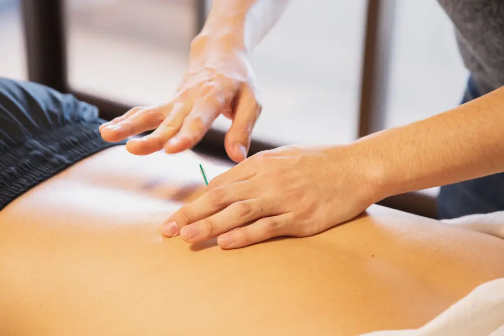 Dry needling treatment for muscle tension and movement restrictions.